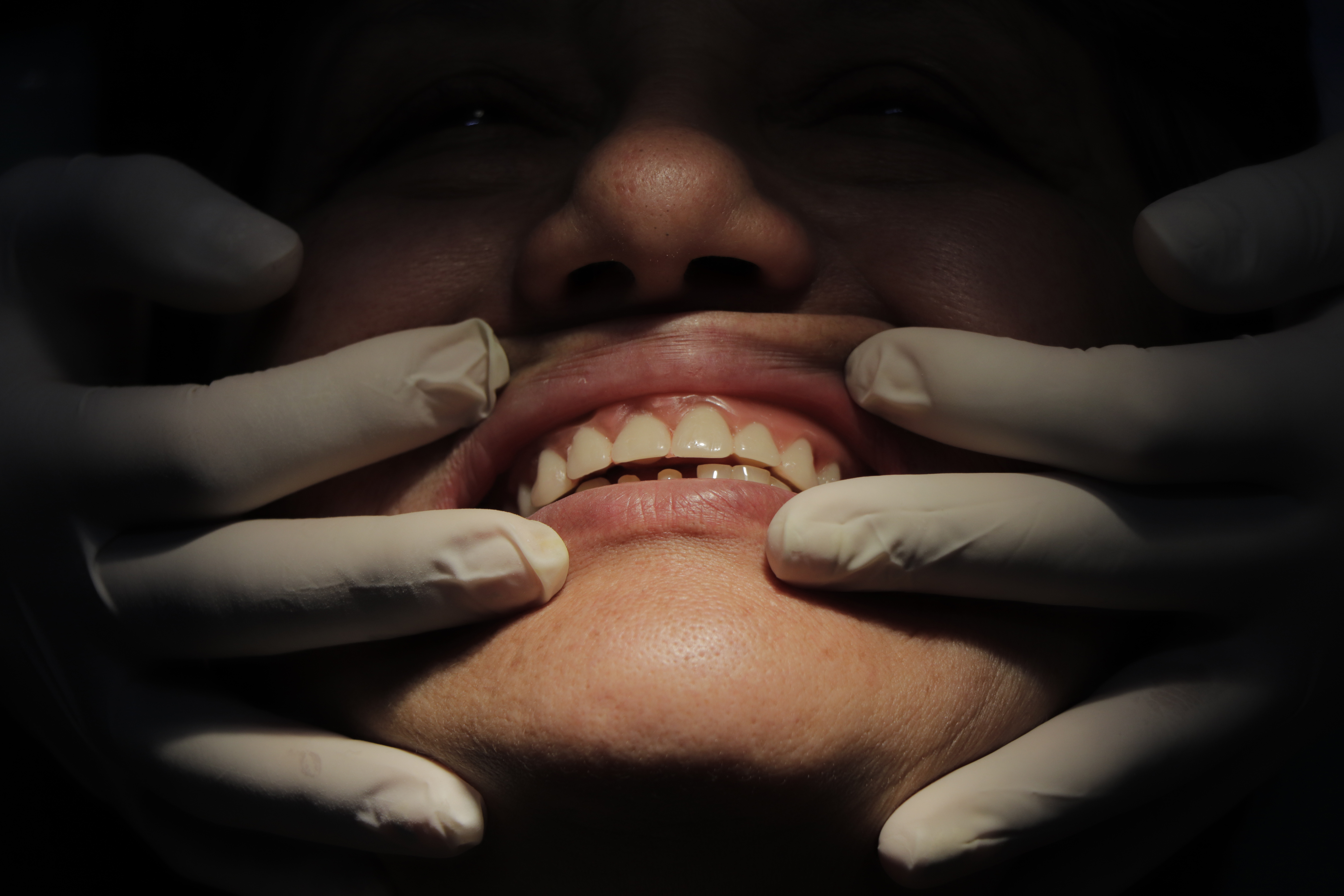 Gloved fingers on a person's face in the dark