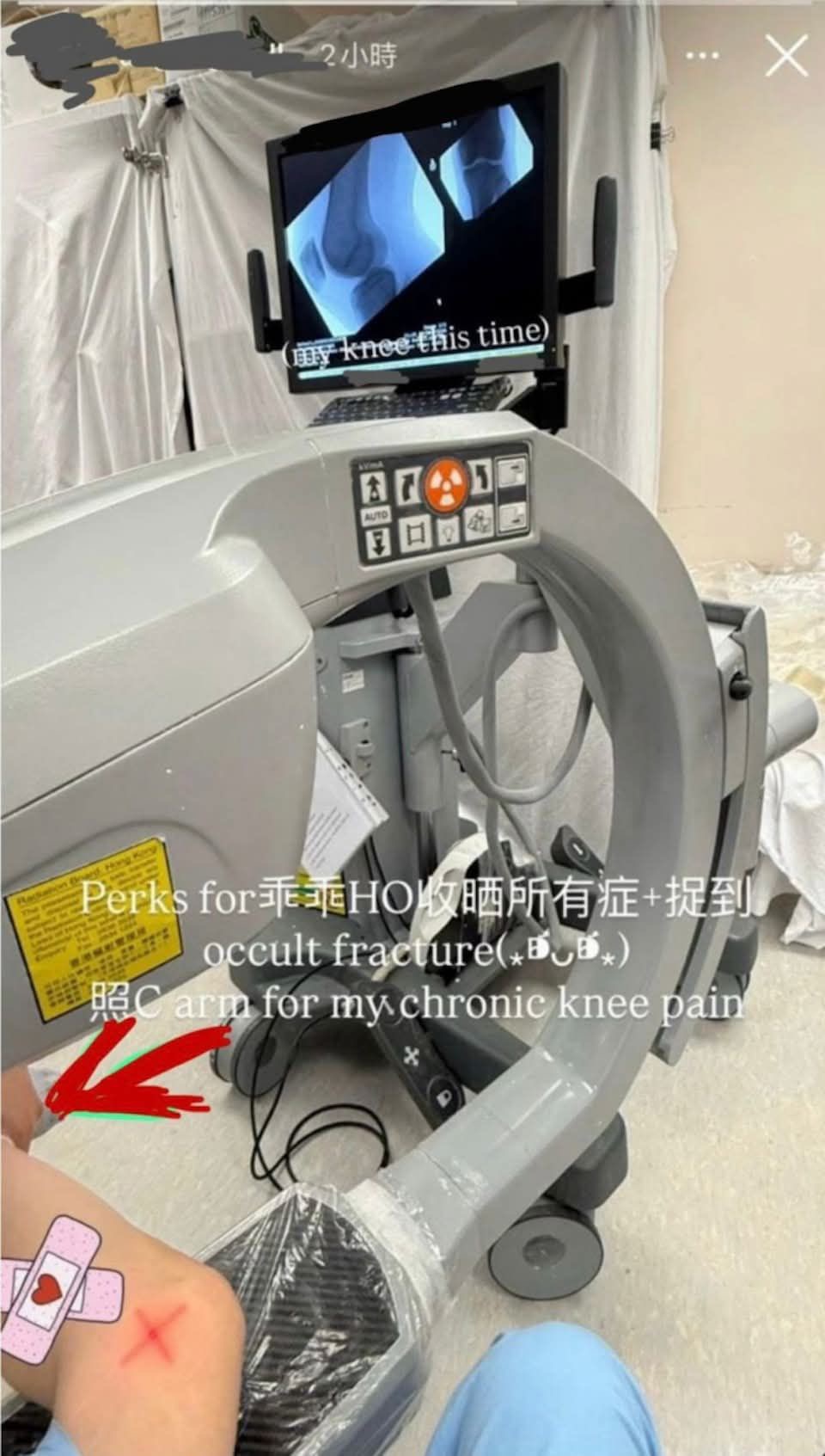 A photo shared by an intern doctor shows her performing an X-ray on her own knee.