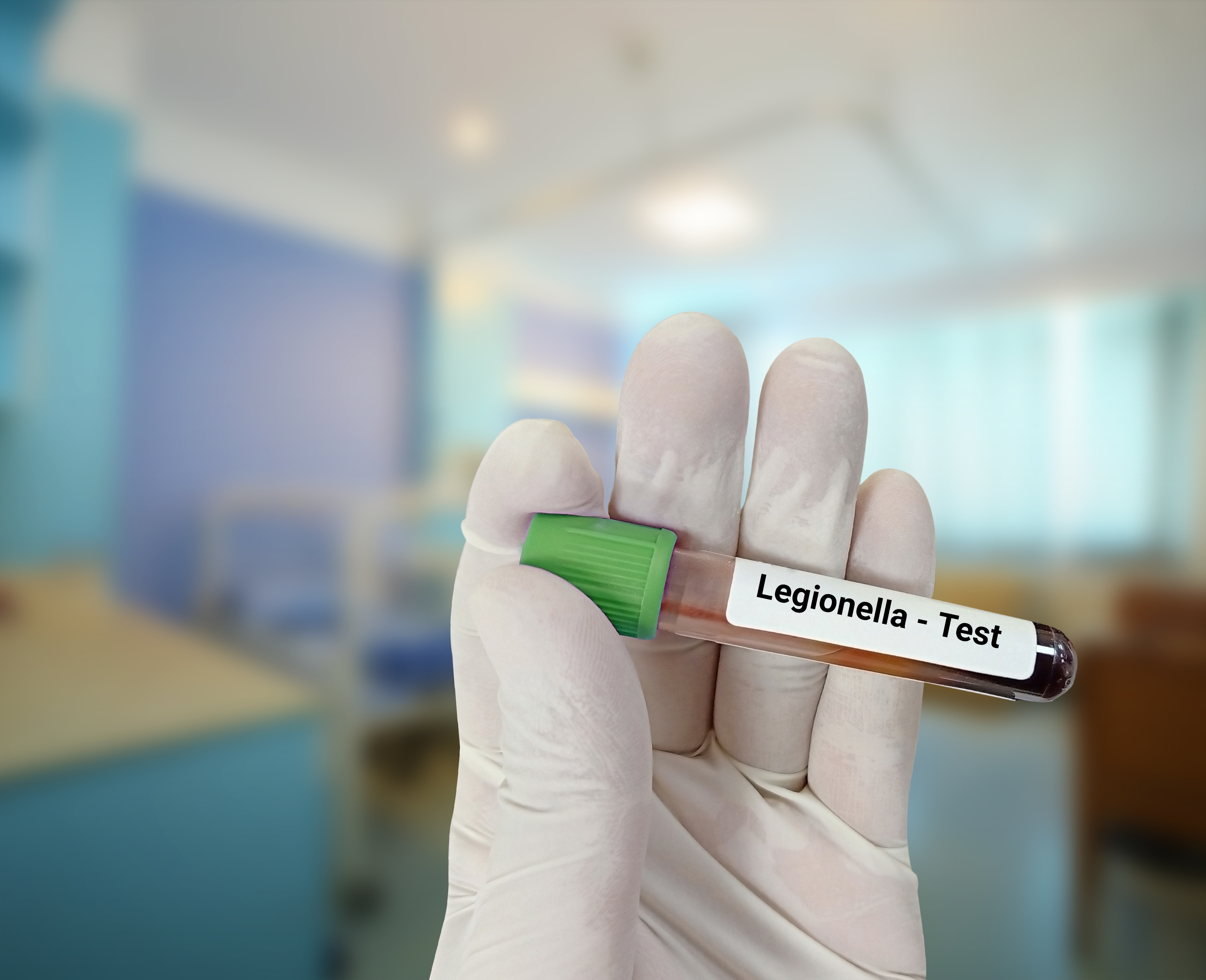 Legionella test