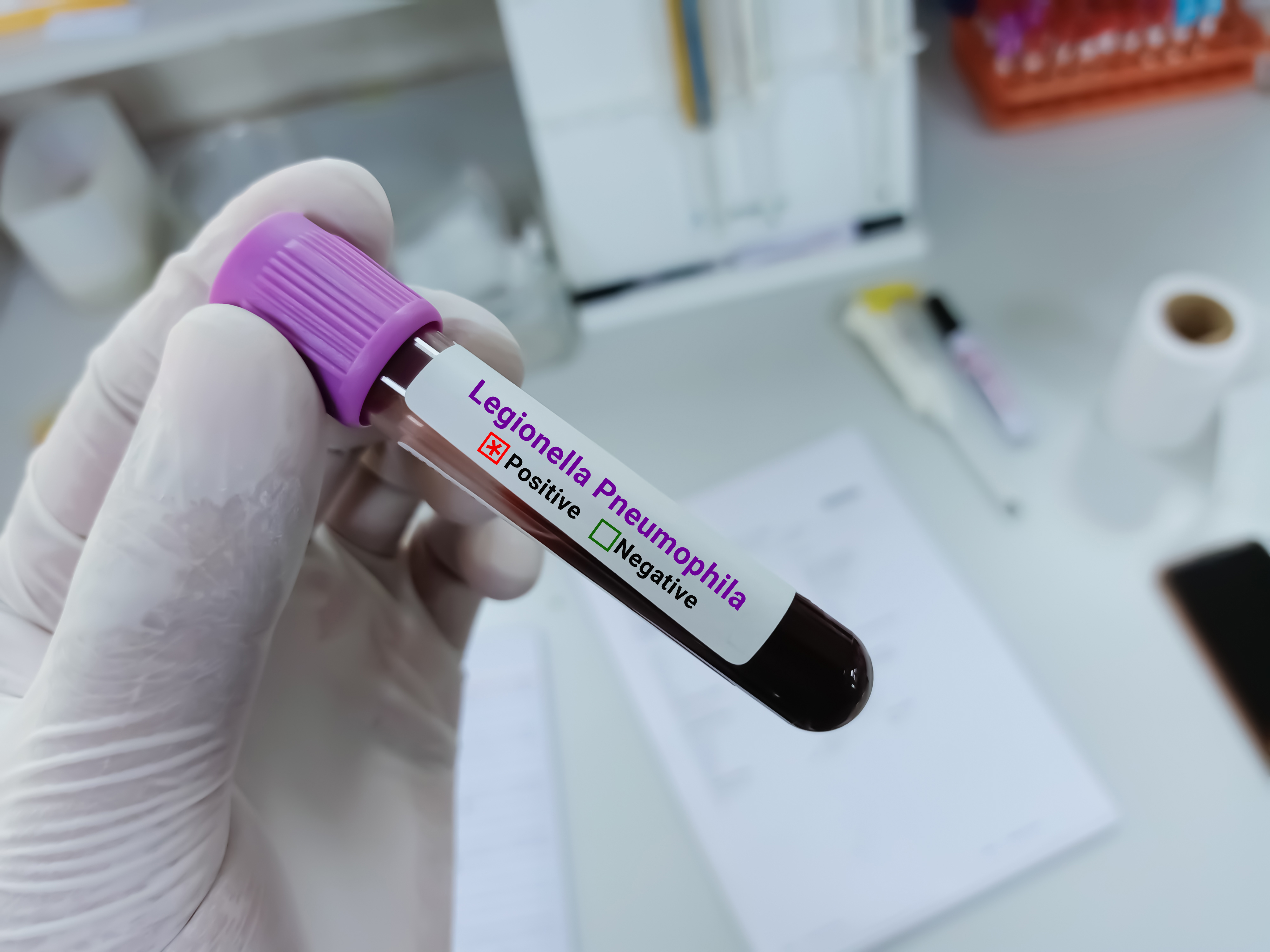 Legionella testing