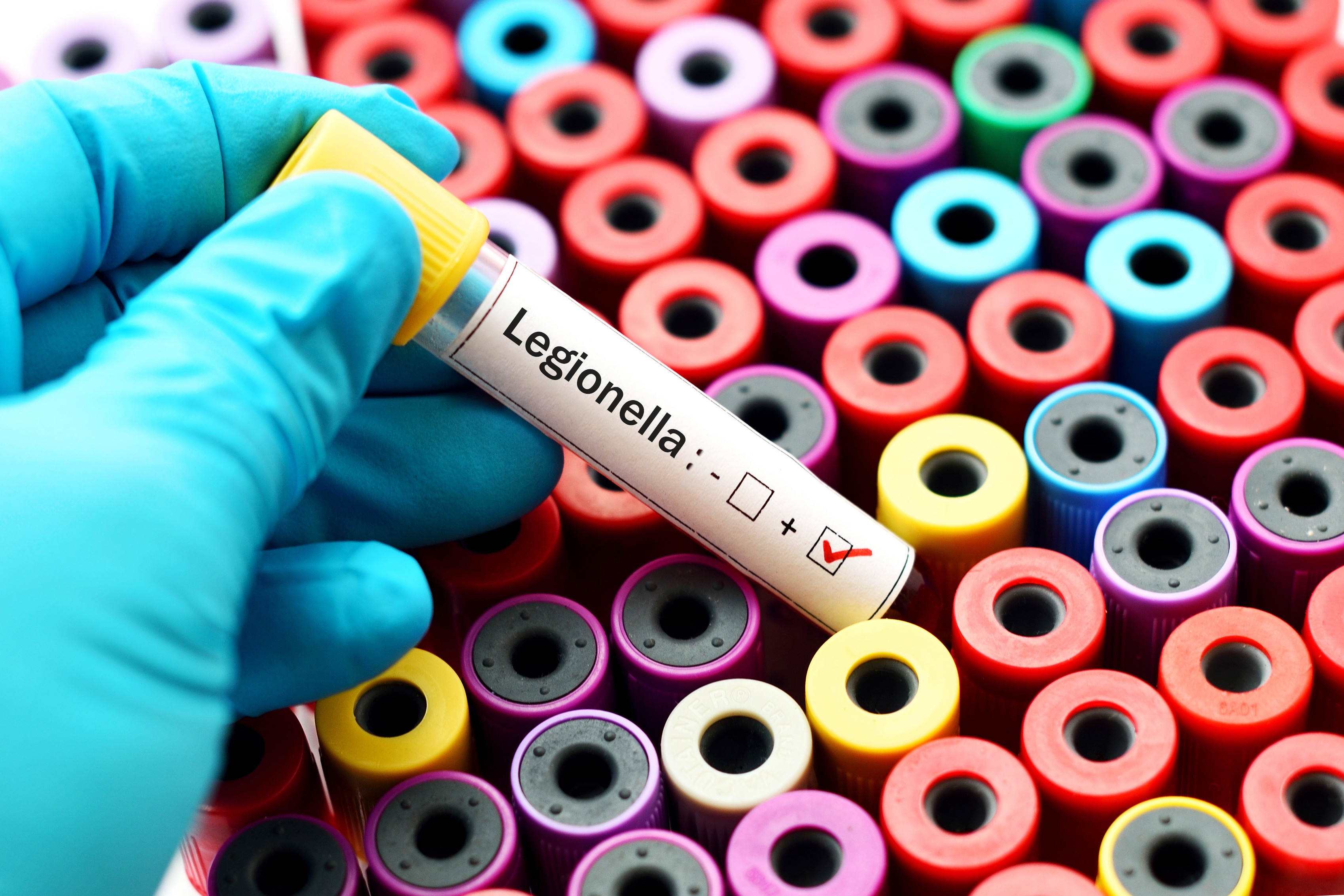Testing sample positive with Legionella.