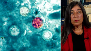 Seg2 cyclosporiasis drhoury