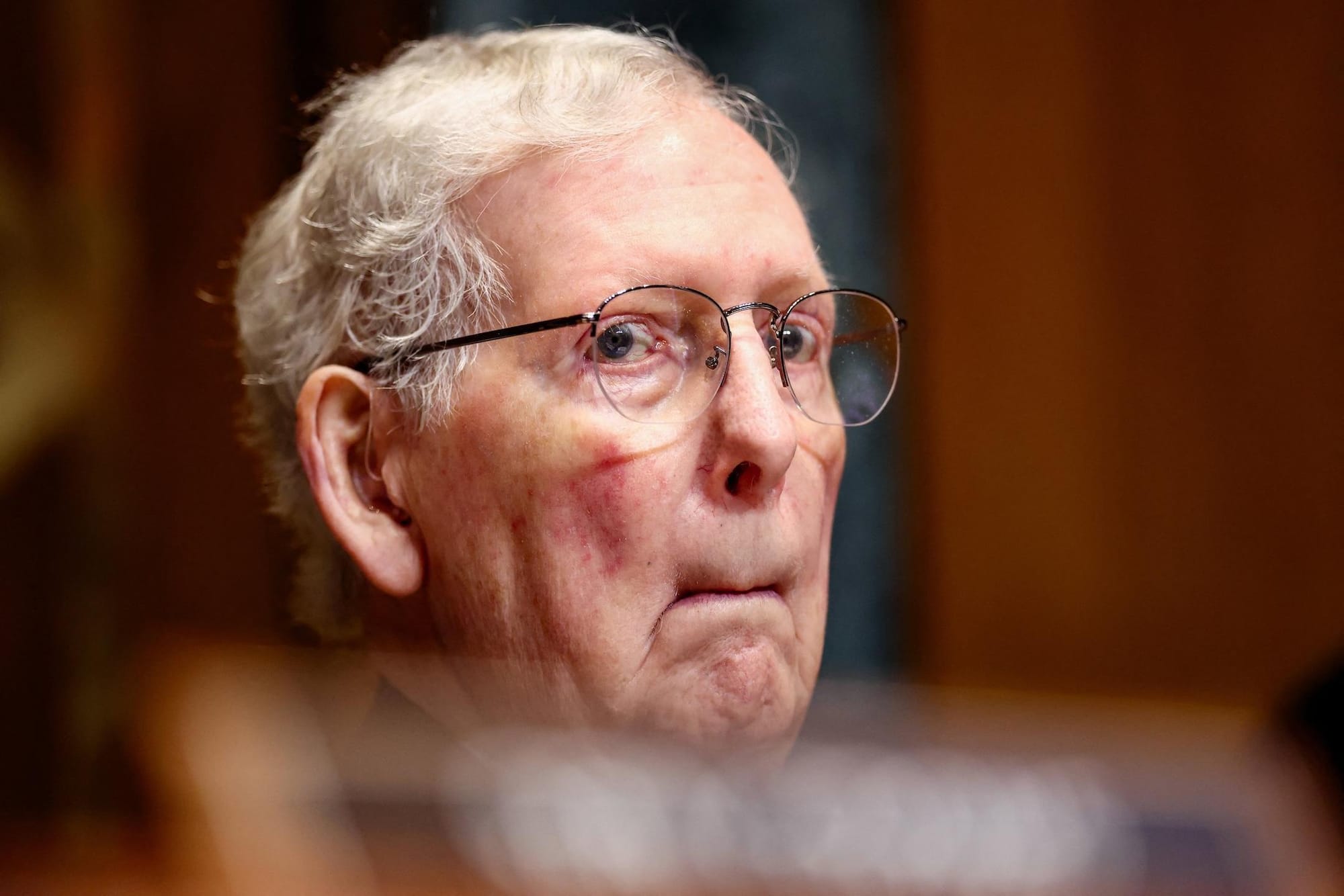 What we know about Mitch McConnell's health