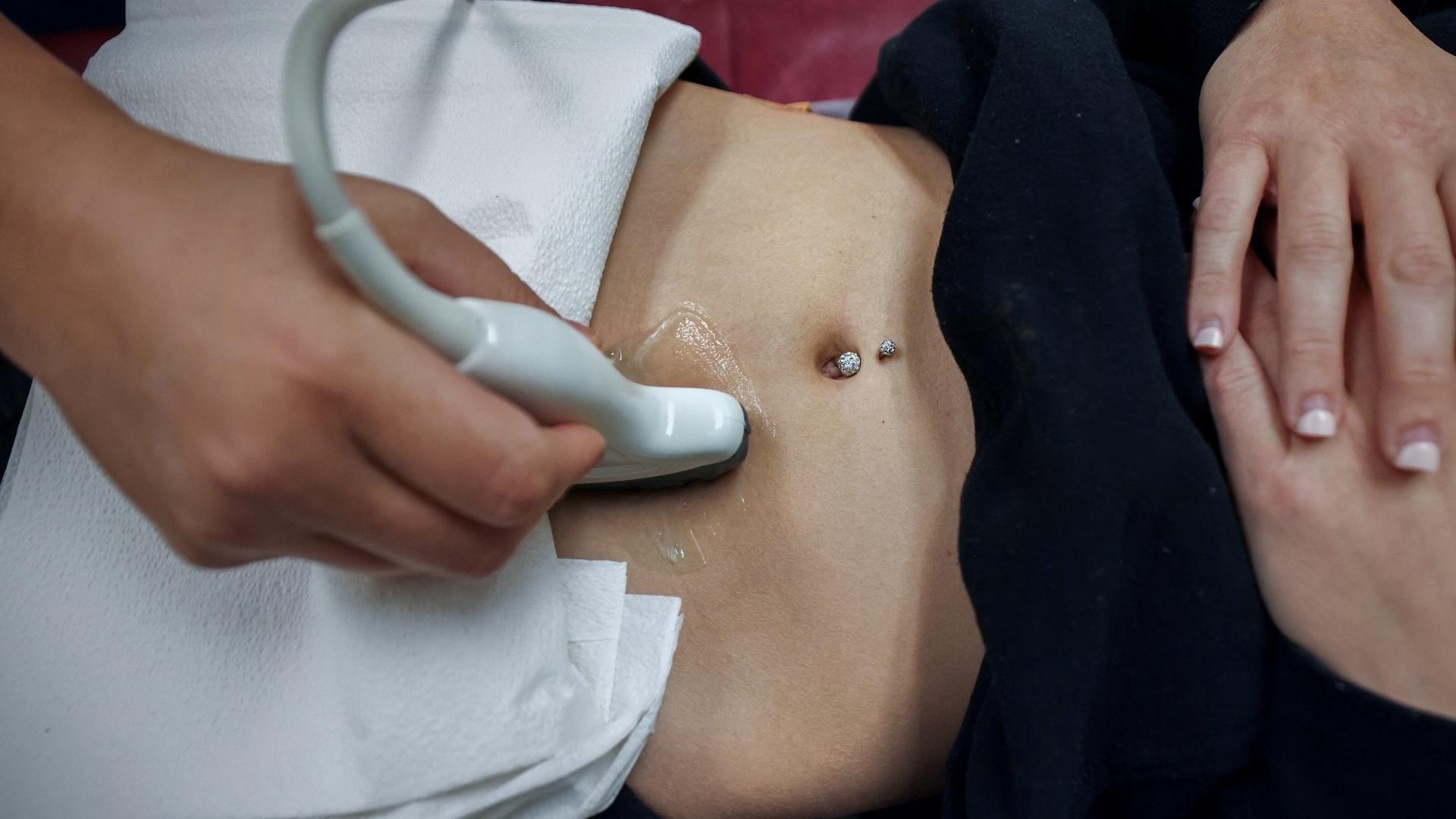 Why doctors say abortion bans worsen care for miscarriages